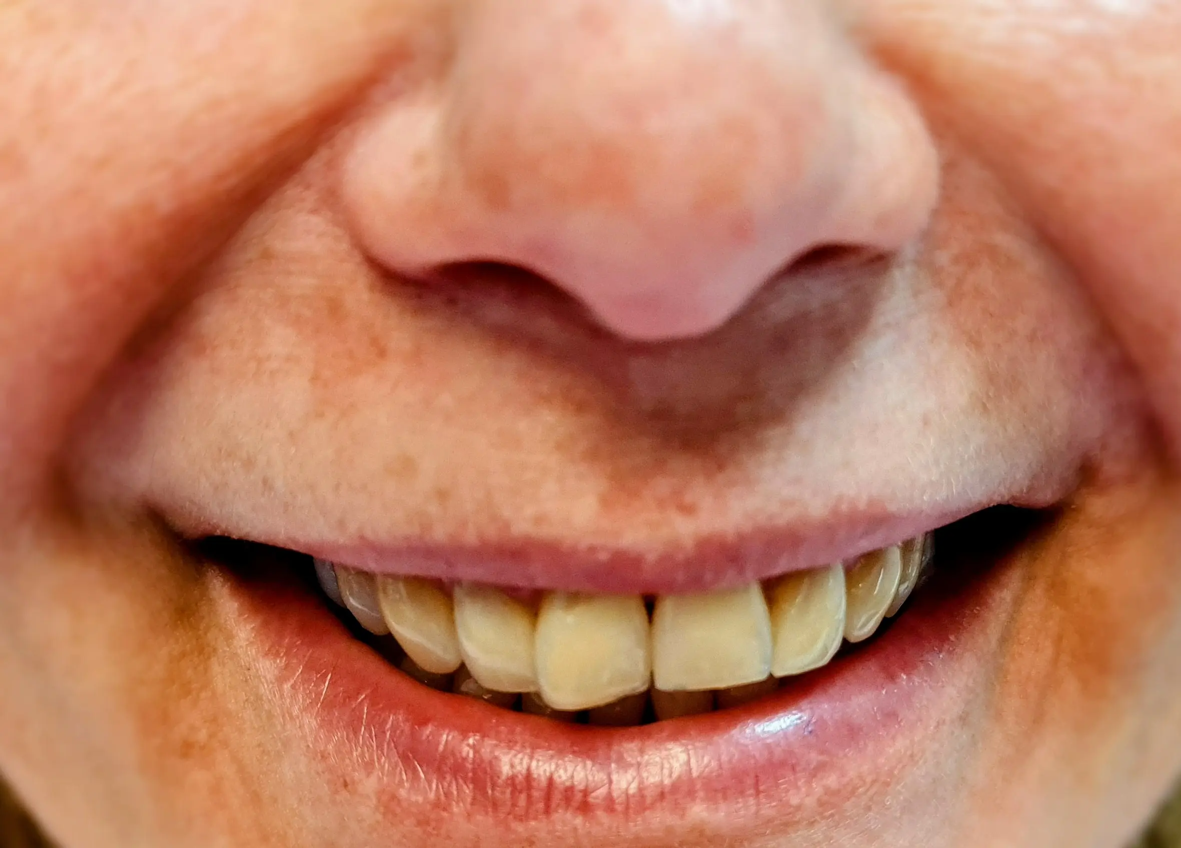 Ortodonție înainte - CadTech Dental București